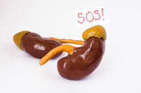 Ung thư niệu quản - Hình ảnh minh họa